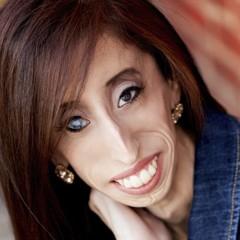 Lizzie Velasquez