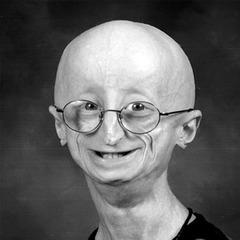 Sam Berns